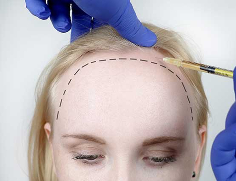 Slider image (8) Biruni Hair Institute